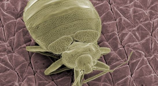 В жилых домах живут тысячи неизвестных видов бактерий и насекомых